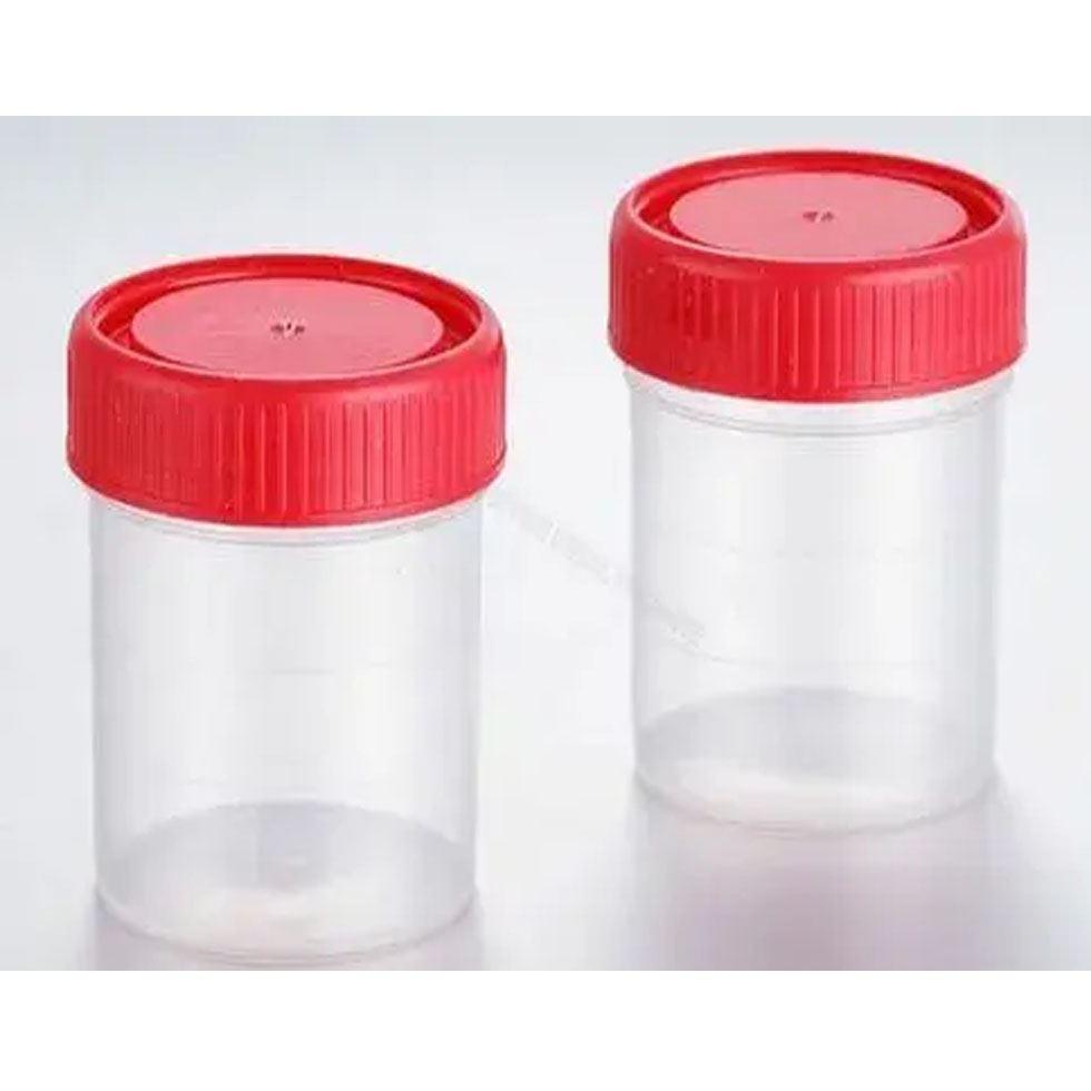 Urine Culture Bottles Image