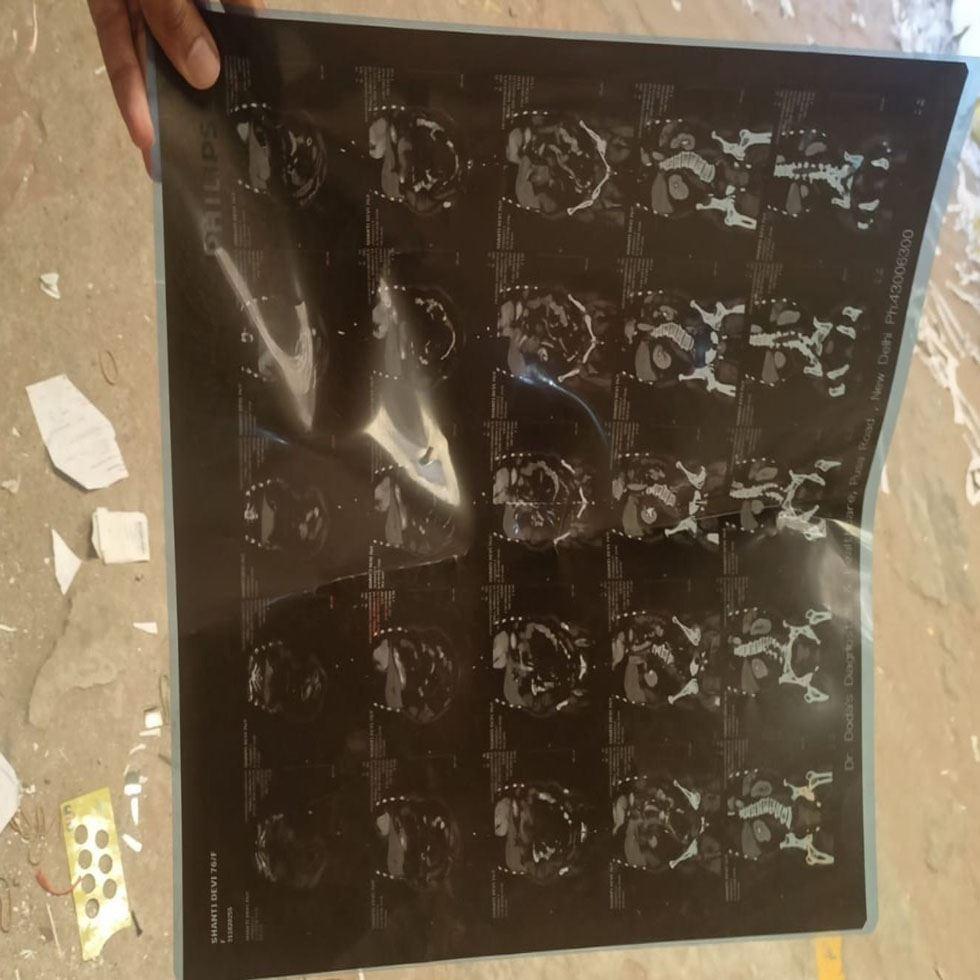 X Ray Film Scrap Image